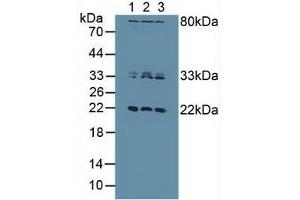 Western blot analysis of (1) Human HeLa cells, (2) Human Jurkat Cells and (3) Human MCF7 Cells. (Dual Specificity Phosphatase 3 (DUSP3) (AA 2-185) Antikörper)