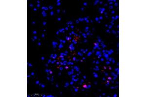 Immunofluorescence of paraffin embedded rat hippocampus using groucho (ABIN7075961) at dilution of 1:1000 (350x lens)