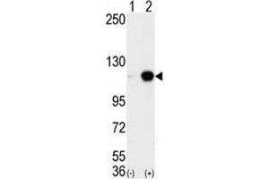 Western blot analysis of LSD1 antibody and 293 cell lysate either nontransfected (Lane 1) or transiently transfected with the AOF2 gene (2). (LSD1 Antikörper  (AA 819-852))