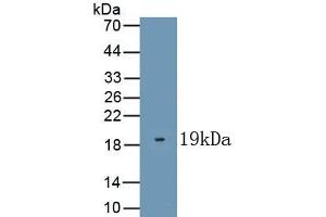 Detection of Recombinant KISS1, Human using Polyclonal Antibody to Kisspeptin 1 (KISS1) (KISS1 Antikörper  (AA 20-138))