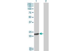 Western Blot analysis of RCV1 expression in transfected 293T cell line by RCV1 monoclonal antibody (M13), clone 1B9. (Recoverin Antikörper  (AA 101-199))