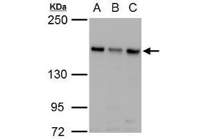 WB Image ROCK2 antibody detects ROCK2 protein by western blot analysis. (ROCK2 Antikörper)