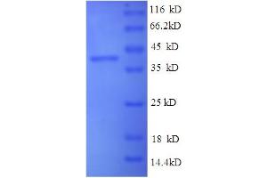 SDS-PAGE (SDS) image for Synuclein, alpha (SNCA) (AA 1-140), (full length) protein (His tag) (ABIN5710386) (SNCA Protein (AA 1-140, full length) (His tag))