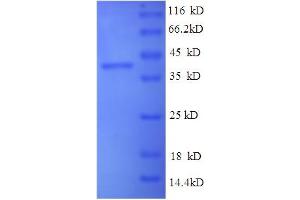 SDS-PAGE (SDS) image for Synuclein, alpha (SNCA) (AA 1-140), (full length) protein (His tag) (ABIN5710386) (SNCA Protein (AA 1-140, full length) (His tag))