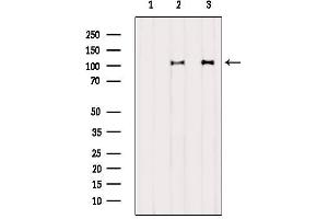 Western blot analysis of extracts from various samples, using DDX58  Antibody. (DDX58 Antikörper  (N-Term))