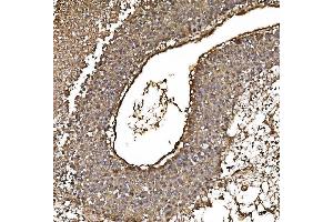 IHC analysis of PARK7/DJ1 using anti-PARK7/DJ1 antibody (ABIN7600468). (PARK7/DJ1 Antikörper  (AA 2-189))