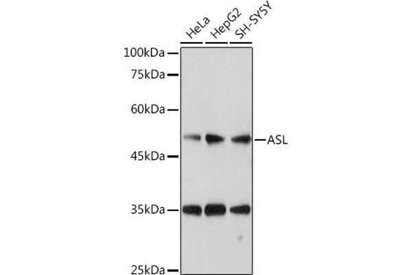 ASL anticorps  (AA 1-300)
