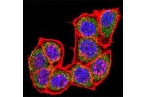 Confocal immunofluorescent analysis of p38 antibody with HeLa cells followed by Alexa Fluor 488-conjugated goat rabbit lgG (green).