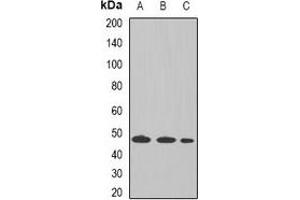 Western blot analysis of Tapasin expression in THP1 (A), Raji (B), mouse liver (C) whole cell lysates. (TAPBP Antikörper)