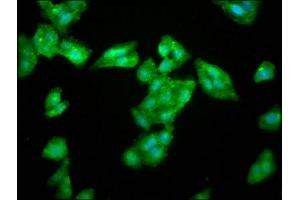 Immunofluorescence staining of HepG2 cells with ABIN7168164 at 1:266, counter-stained with DAPI. (LAS1L Antikörper  (AA 490-565))