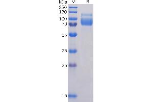 Human SIG Protein, His Tag on SDS-PAGE under reducing condition.