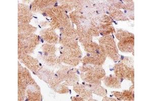 IHC analysis of FFPE human skeletal muscle section using SDHA antibody; Ab was diluted at 1:25. (SDHA Antikörper  (AA 577-605))