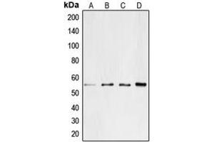 Western blot analysis of CD4 expression in Jurkat (A), SP2/0 (B), PC12 (C), H9C2 (D) whole cell lysates. (CD4 Antikörper  (C-Term))