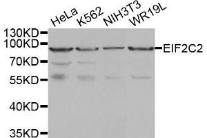 Western Blotting (WB) image for anti-Argonaute 2 (AGO2) antibody (ABIN1877052) (AGO2 Antikörper)