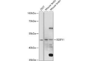Western blot analysis of extracts of various cell lines, using IGSF11 antibody (ABIN7267849) at 1:1000 dilution. (IGSF11 Antikörper  (AA 80-200))