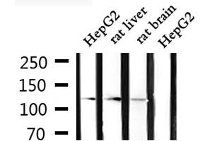 Western blot analysis of extracts from HepG2, rat liver and rat brain, using CLIP2 Antibody. (CLIP2 Antikörper  (C-Term))