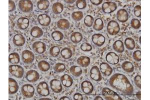 Image no. 1 for anti-N-Deacetylase/N-Sulfotransferase (Heparan Glucosaminyl) 1 (NDST1) (AA 38-137) antibody (ABIN598755) (NDST1 Antikörper  (AA 38-137))