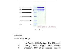Gel Scan of Kininogen, HMW, Human Plasma  This information is representative of the product ART prepares, but is not lot specific.