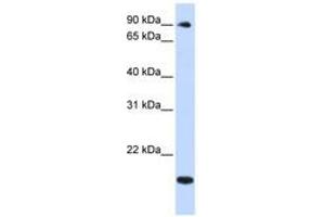 Image no. 1 for anti-TSR1, 20S rRNA Accumulation, Homolog (TSR1) (AA 648-697) antibody (ABIN6740961) (TSR1 Antikörper  (AA 648-697))