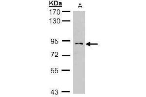 WB Image Sample(30 ug whole cell lysate) A:H1299 7. (GCS1 Antikörper)