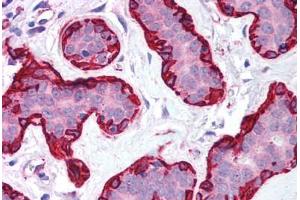 Human Breast (formalin-fixed, paraffin-embedded) stained with ACTA2 antibody ABIN213651 at 5 ug/ml followed by biotinylated goat anti-rabbit IgG secondary antibody ABIN481713, alkaline phosphatase-streptavidin and chromogen. (Smooth Muscle Actin Antikörper  (N-Term))