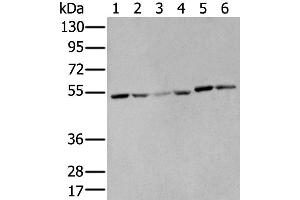 Western Blotting (WB) image for anti-Matrix Metallopeptidase 1 (Interstitial Collagenase) (MMP1) antibody (ABIN2427602) (MMP1 Antikörper)
