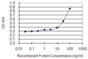 Detection limit for recombinant GST tagged MYO1E is 0. (MYO1E Antikörper  (AA 918-1014))