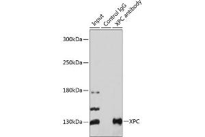 Immunoprecipitation analysis of 200 μg extracts of 293T cells using 3 μg XPC antibody ( ABIN6128932, ABIN6150295, ABIN6150296 and ABIN6224381). (XPC Antikörper  (AA 700-940))