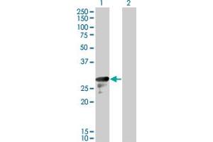 Western Blot analysis of DENR expression in transfected 293T cell line by DENR monoclonal antibody (M01), clone 1H3.
