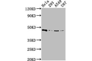 Western Blot Positive WB detected in: Hela whole cell lysate, 293 whole cell lysate, A549 whole cell lysate, U87 whole cell lysate All lanes: MAP2K1 antibody at 1:2000 Secondary Goat polyclonal to rabbit IgG at 1/50000 dilution Predicted band size: 44, 41 kDa Observed band size: 44 kDa (Rekombinanter MEK1 Antikörper)