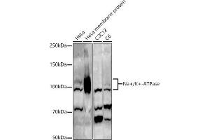 Western blot analysis of extracts of various cell lines, using Na+/K+-ATPase antibody (ABIN6133568, ABIN6137299, ABIN6137301 and ABIN6223860) at 1:500 dilution. (ATP1A1 Antikörper  (AA 1-100))