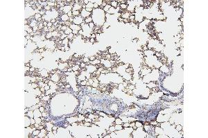 IHC analysis of NF2 using anti-NF2 antibody (ABIN7600115). (Merlin Antikörper  (AA 15-565))