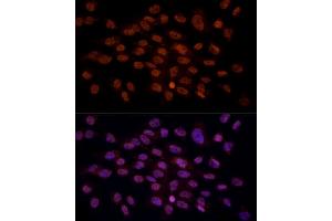 Immunofluorescence analysis of C6 cells using CRYGC antibody (ABIN6130868, ABIN6139079, ABIN6139080 and ABIN6224977) at dilution of 1:100 (40x lens). (CRYGC Antikörper  (AA 1-174))