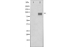 Western blot analysis of Glycogen Synthase expression in Serum treated HeLa whole cell lysates,The lane on the left is treated with the antigen-specific peptide.
