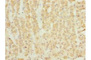 Immunohistochemistry of paraffin-embedded human adrenal gland tissue using ABIN7151524 at dilution of 1:100 (ELMOD1 Antikörper  (AA 185-334))