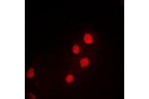 Immunofluorescent analysis of PDCD5 staining in MCF7 cells. (PDCD5 Antikörper)