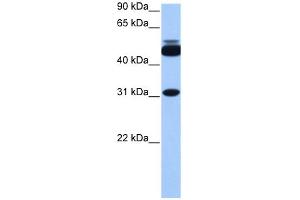 WB Suggested Anti-CYLC2 Antibody Titration: 0.