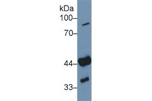 Detection of ADA in Human Jurkat cell lysate using Polyclonal Antibody to Adenosine Deaminase (ADA) (ADA Antikörper  (AA 11-280))