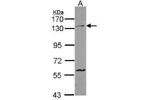 WB Image Sample (30 ug of whole cell lysate) A: HCT116 7. (Protocadherin 1 Antikörper  (C-Term))