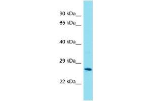 Western Blotting (WB) image for anti-Glutathione S-Transferase theta 2 (GSTT2) (Middle Region) antibody (ABIN2440859) (GSTT2 Antikörper  (Middle Region))