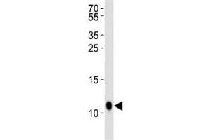 Western blot analysis of lysate from Drosophila tissue lysate using SUMO antibody diluted at 1:1000. (SUMO Antikörper  (AA 37-66))