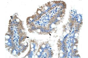 GTPBP9 antibody was used for immunohistochemistry at a concentration of 4-8 ug/ml to stain Epithelial cells of intestinal villus (arrows) in Human Intestine. (OLA1 Antikörper)