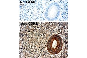 Immunohistochemistry (IHC) image for anti-Cadherin 1, Type 1, E-Cadherin (Epithelial) (CDH1) antibody (ABIN1440031) (E-cadherin Antikörper)