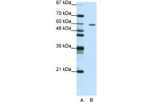 WB Suggested Anti-ZNF382 Antibody Titration:  1. (ZNF382 Antikörper  (N-Term))
