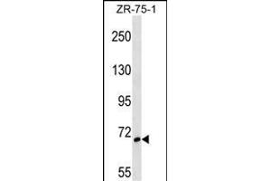 SH3BP1 Antibody (Center) (ABIN1538408 and ABIN2848605) western blot analysis in ZR-75-1 cell line lysates (35 μg/lane). (SH3BP1 Antikörper  (AA 419-446))