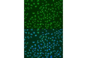 Immunofluorescence analysis of U2OS cells using ELAVL1 antibody (ABIN6292898) at dilution of 1:100. (ELAVL1 Antikörper)