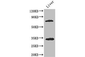 Western Blot Positive WB detected in: Mouse liver tissue All lanes: HDAC10 antibody at 3.