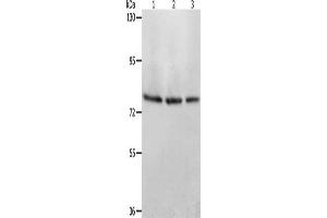 Gel: 8 % SDS-PAGE, Lysate: 40 μg, Lane 1-3: Mouse stomach tissue, Mouse liver tissue, Mouse kidney tissue, Primary antibody: ABIN7128170(ACOX1 Antibody) at dilution 1/350, Secondary antibody: Goat anti rabbit IgG at 1/8000 dilution, Exposure time: 1 minute (ACOX1 Antikörper)