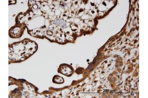 Immunoperoxidase of monoclonal antibody to HECTD2 on formalin-fixed paraffin-embedded human placenta.