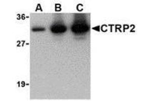 Western blot of recombinant CTRP2: (A) 5 ng, (B) 25 ng, and (C) 50 ng with AP30250PU-N CTRP2 at 1 ug/ml. (C1QTNF2 Antikörper)